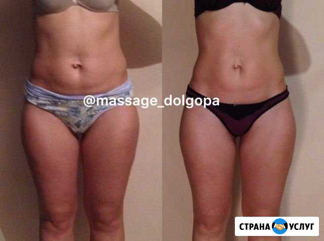 Массаж. Ручная Коррекция фигуры Долгопрудный - изображение 1