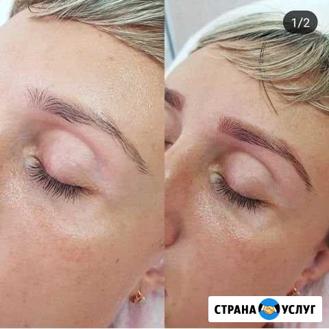 Косметология Светлогорск - изображение 1