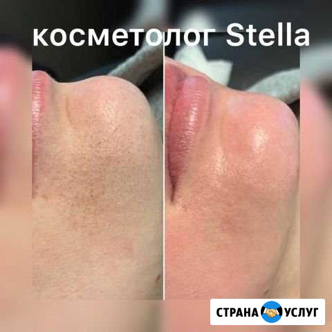 Косметолог с медицинским образованием Павловская Слобода - изображение 1