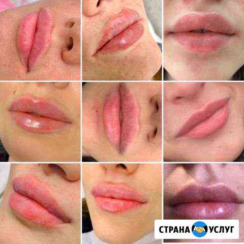 Обучение косметологии Самара