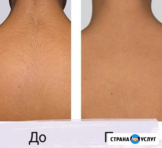 Шугаринг Одинцово - изображение 1