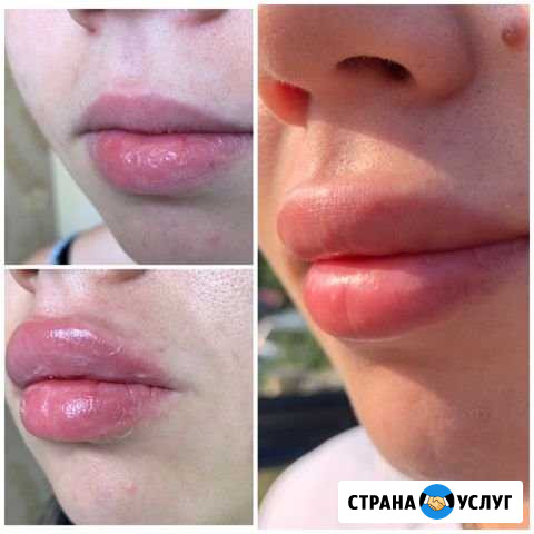 Услуги Косметолога Новороссийск - изображение 1