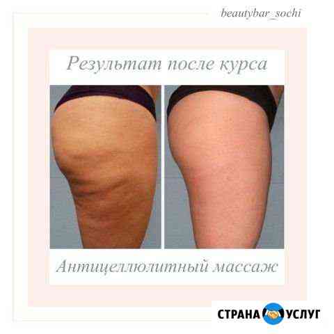 Массаж Сочи