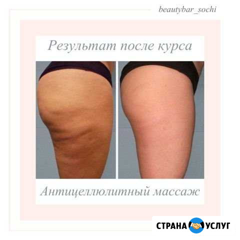 Массаж Сочи - изображение 1