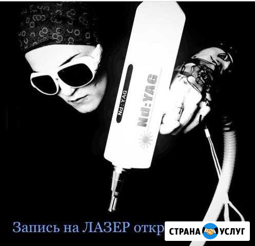 Удаление татуировок и татуажа Тольятти - изображение 1