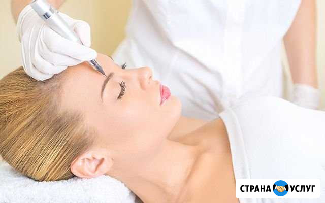 Электроэпиляция Пермь - изображение 1