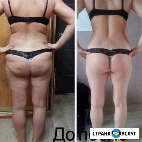 Вакуумный массаж кавитация рфлифтинг + обучение Набережные Челны - изображение 1