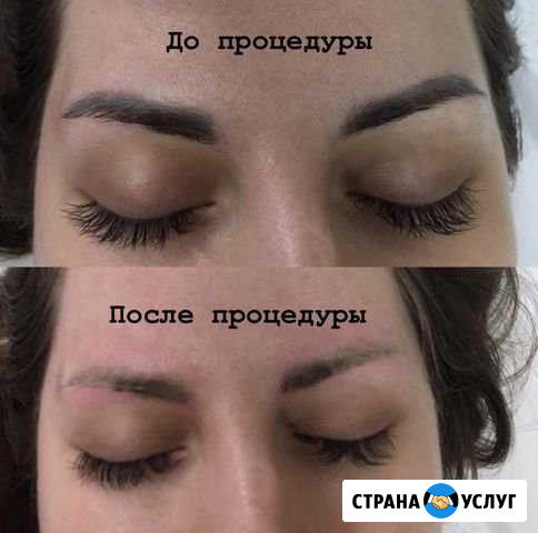 Удаление татуажа и татуировок Люберцы - изображение 1