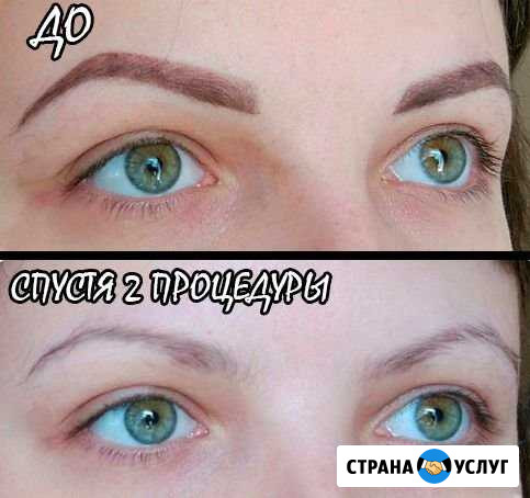 Удаление Татуажа и Тату без боли и шрамов Уфа - изображение 1