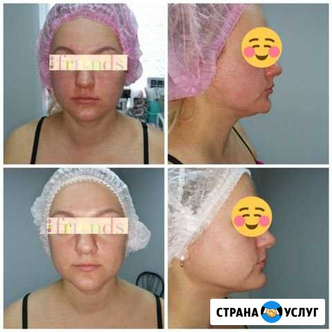 Французский лимфодренажный массаж Барнаул - изображение 1
