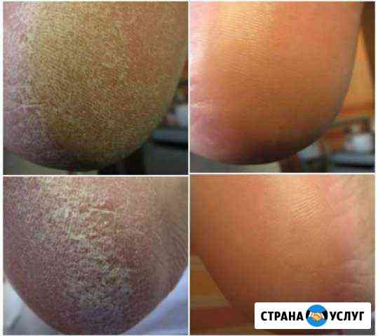 Педикюр Новочеркасск