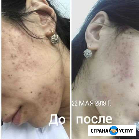 Гимнастика Кизляр - изображение 1