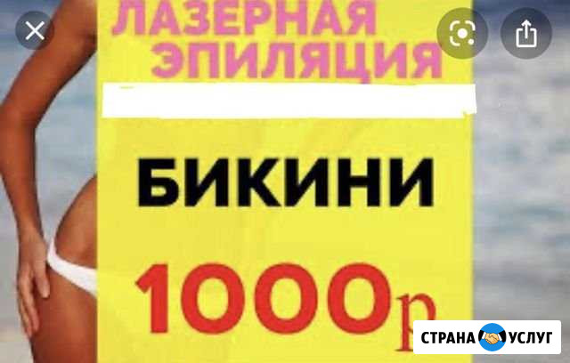 Лазерная эпиляция Элос Красноярск - изображение 1