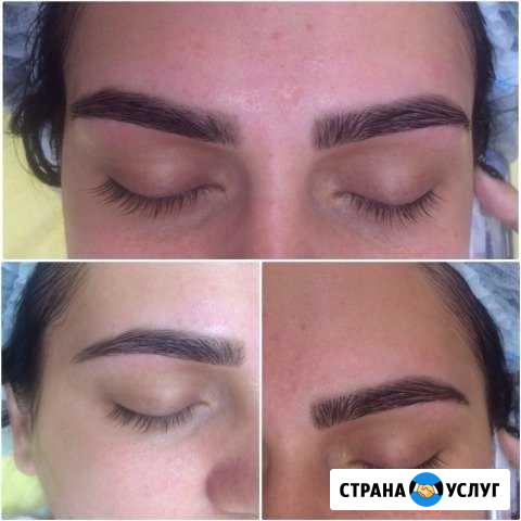 Косметология Самара - изображение 1