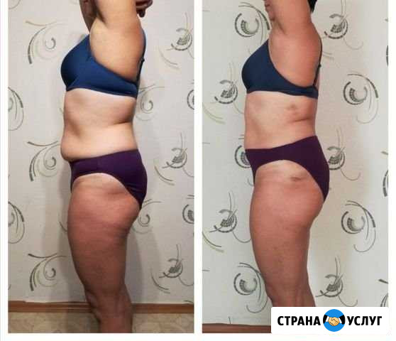Антицеллюлитный массаж Челябинск - изображение 1