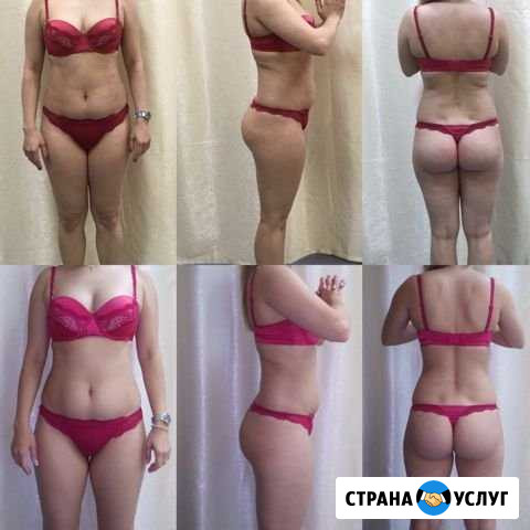 Аппаратная косметология Магнитогорск - изображение 1