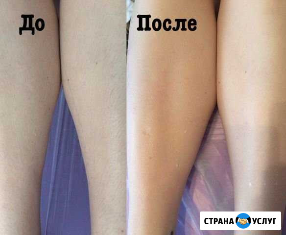 Шугаринг Саранск - изображение 1