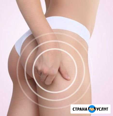 Антицеллюлитная коррекция тела Ижевск - изображение 1
