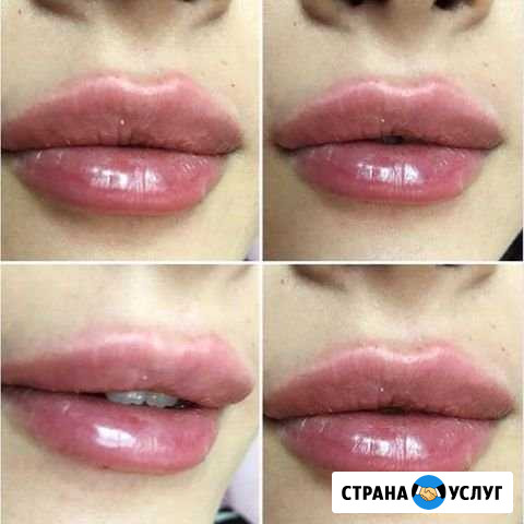 Косметолог-эстетист Саратов - изображение 1