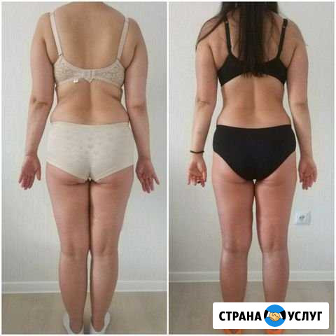 Абонемент на массаж Калининград - изображение 1