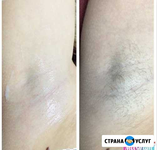 Мастер по шугарингу Курск - изображение 1