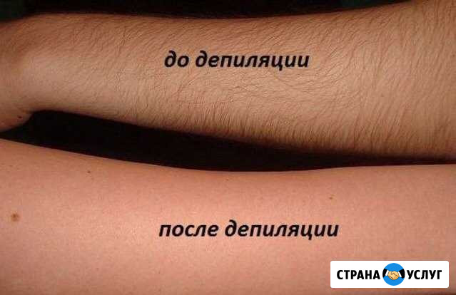 Спа-шугаринг, сахарная эпиляция, шугаринг Чита - изображение 1