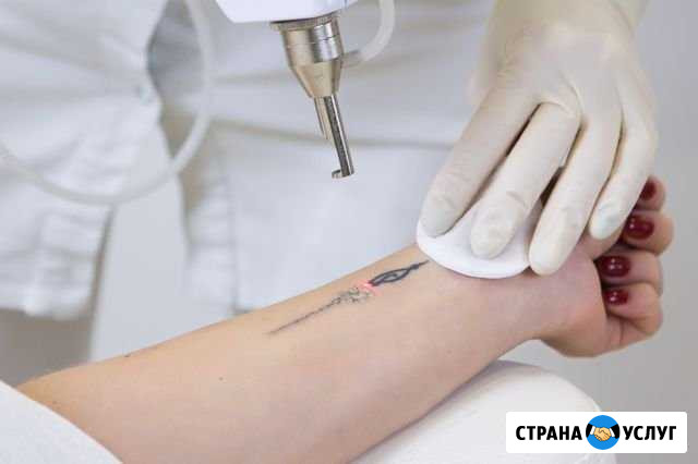 Удаление тату и татуажа неодимовым лазером Ленинск-Кузнецкий - изображение 1