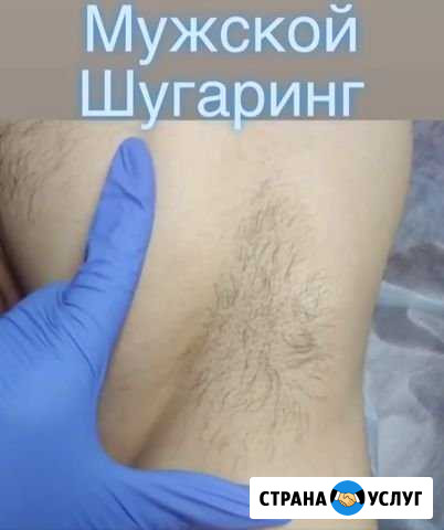 Депиляция для мужчин Махачкала - изображение 1