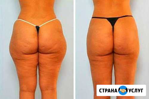 Массаж Ижевск - изображение 1