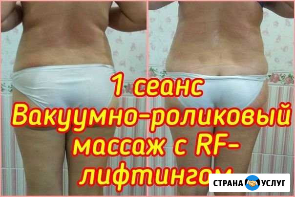 Кавитация и RF - лифтинг Красноярск - изображение 1