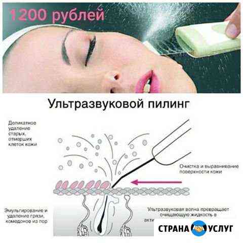 Ультразвуковой пилинг Анапа