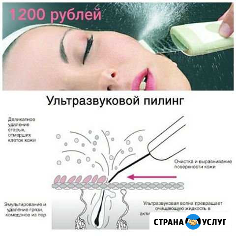 Ультразвуковой пилинг Анапа - изображение 1