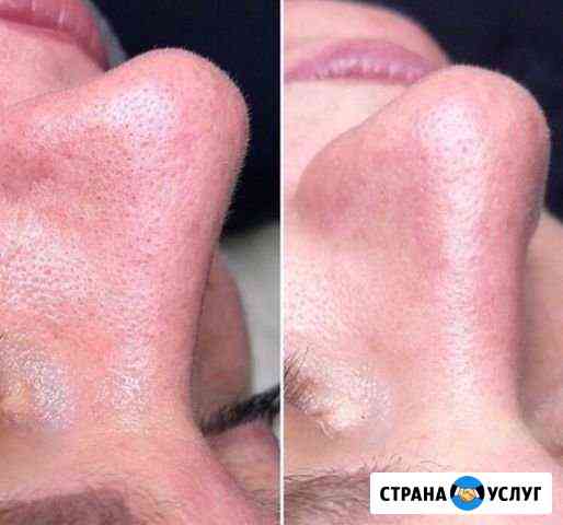 Косметолог Шугаринг Воронеж