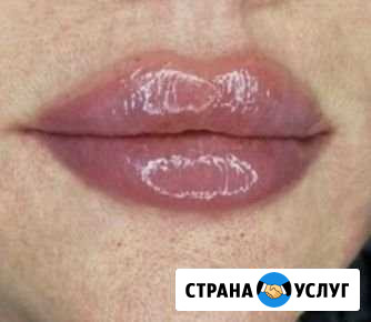 Эпиляция шугаринг косметология Махачкала - изображение 1
