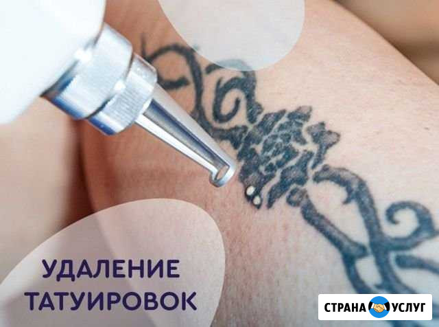 Удаление тату и татуаж (пм) Иркутск - изображение 1