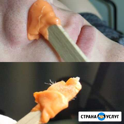 Депиляция /шугаринг саратов Саратов - изображение 1