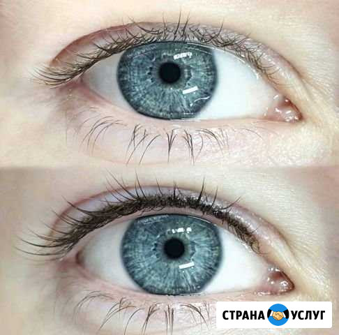 Межресничка Белгород - изображение 1