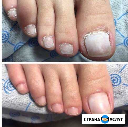Мастер по педикюру Владикавказ - изображение 1
