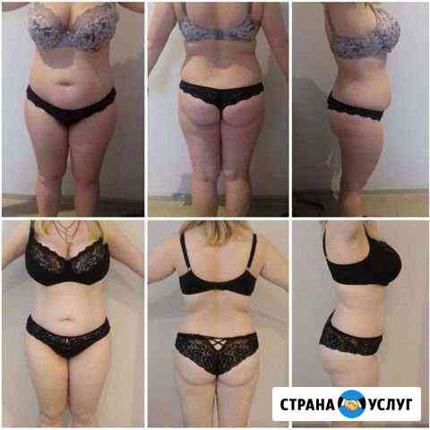 Lpg, кавитация, rf-лифтинг Сочи