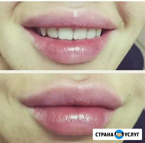 Увлажнения губ Когалым - изображение 1
