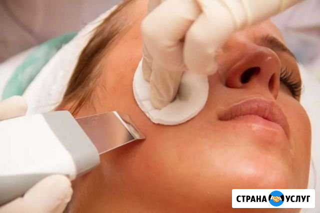 Уз чистка лица Рязань - изображение 1