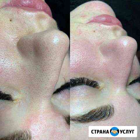 Чистка лица Волгоград