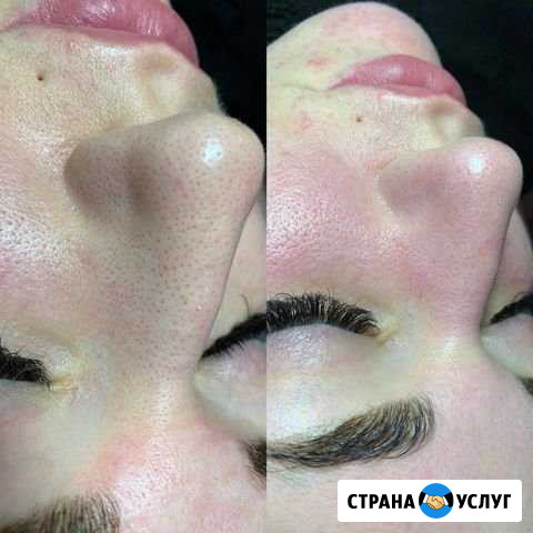 Чистка лица Волгоград - изображение 1