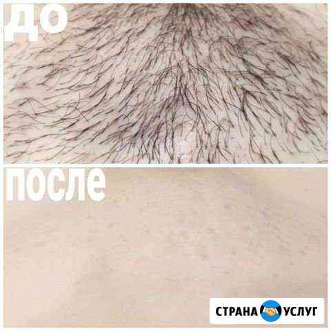 Шугаринг, восковая депиляция Краснодар