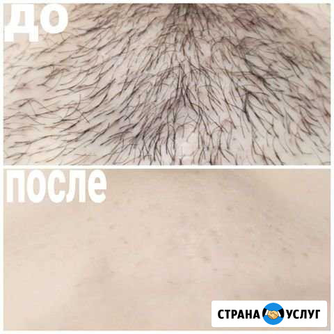 Шугаринг, восковая депиляция Краснодар - изображение 1
