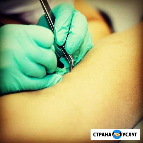 Электроэпиляция Курск - изображение 1