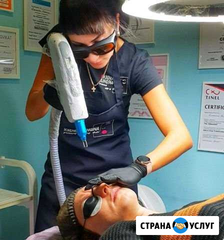 Удаление татуажа и тату, карбоновый пилинг Самара - изображение 1