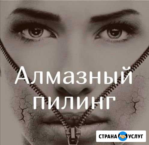 Алмазный пилинг Бузулук - изображение 1