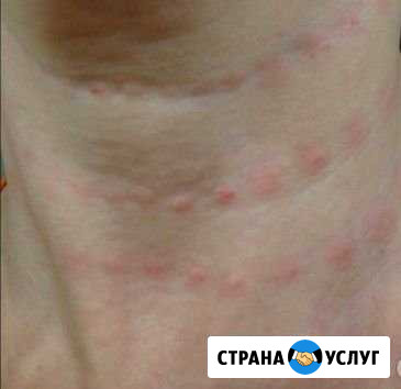 Косметология Майкоп - изображение 1