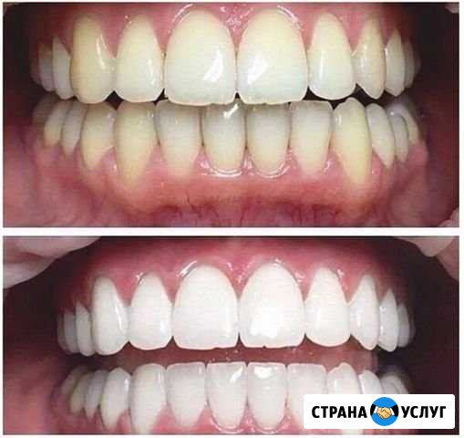 Предоставляю профессиональную,косметическую услугу Волгодонск - изображение 1